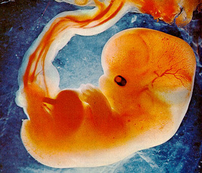 Embrione a 3 settimane 